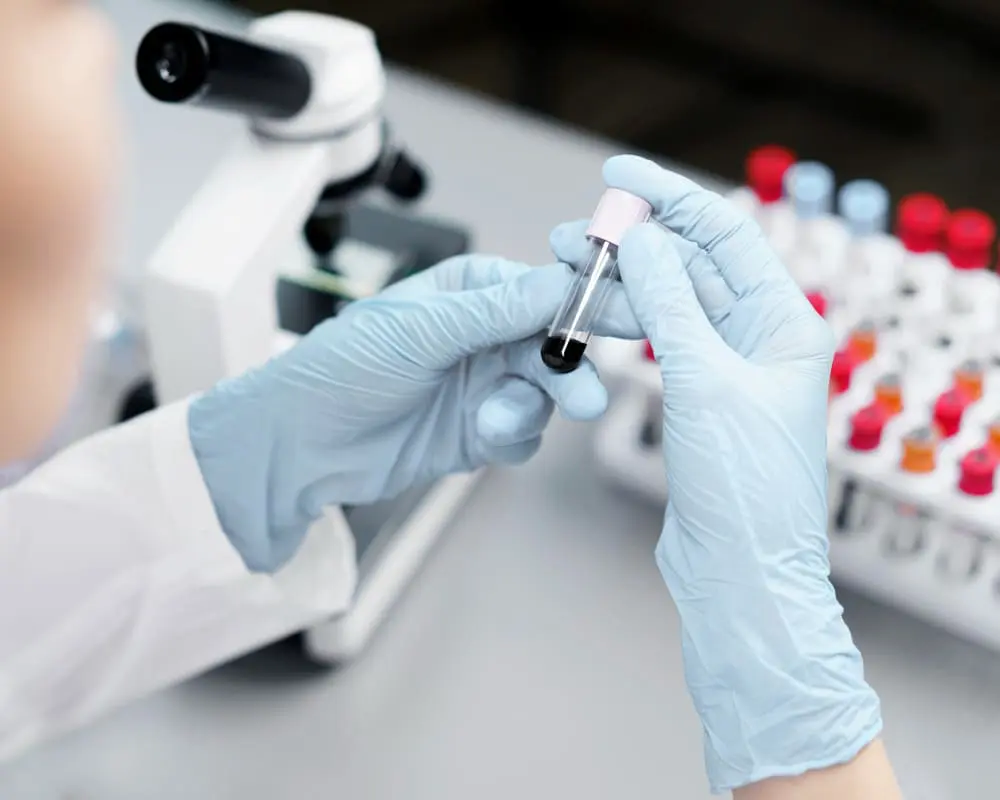 crp-tests-mölab