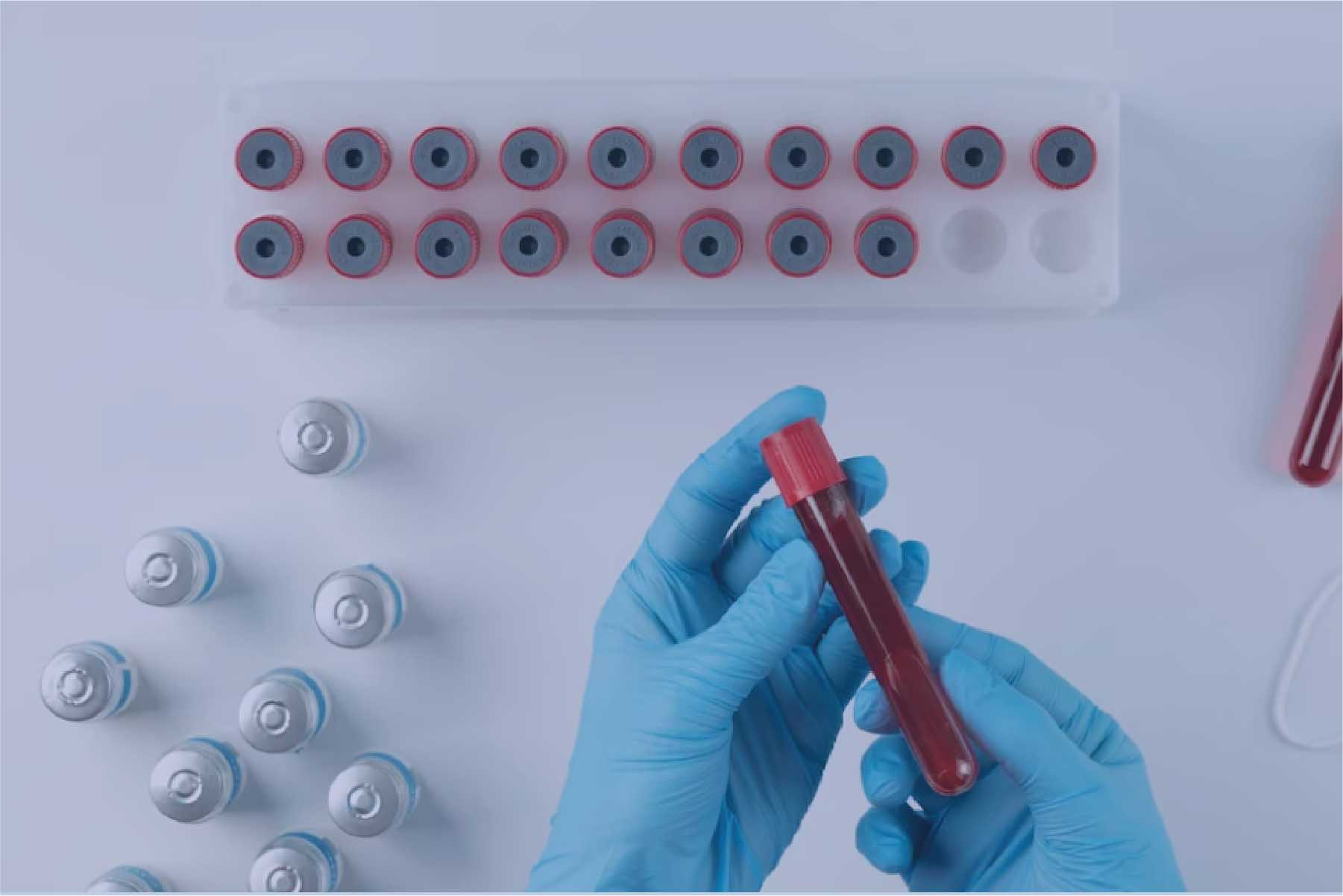 D-Dimer Test